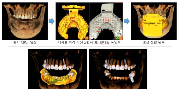 디지털 트레이 활용 영상 정합 workflow