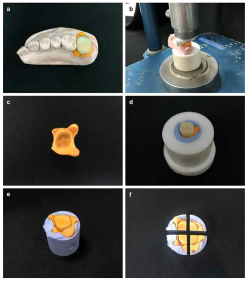 3D printing 된 임시치아의 내면 적합도를 측정하기 위한 실험 과정 (a) Filled with light-body impression materials and seated together with the plaster models (b) 50N of pressure applied for 5 minutes using static load equipment (c) removed from the plaster models after polymerization (d) cylinder-shaped molds filled with putty (e) create the specimen (f) sectioned buccolingually and mesiodistally at the midline