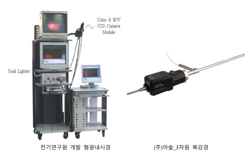 형광내시경 국내 기술의 예시