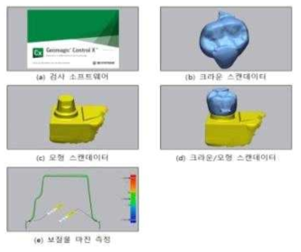 검사 소프트웨어 및 보철물 마진(Gap) 측정 과정