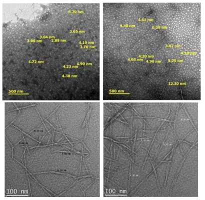 효소-리파이닝 처리 CNF의 TEM 이미지 : CNF 직경 (상 : 나노종합기술원, 하 : DGIST)