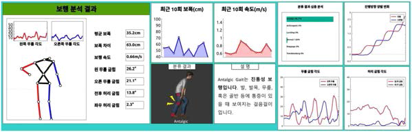 보행 분석 결과 UI