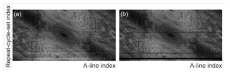 Example of OCT-A map (a) before and (b) after rapid eye motion artifact removal. The vertical and horizontal directions in the images represent the indexes of the repeat-cycle-set and the A-line in the repeat-cycle-set, respectively