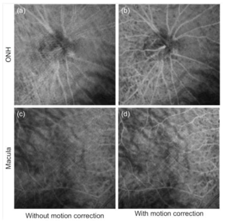 Whole depth en face OCT-A images of (a), (b) the optic nerve head and (c), (d) the macula. (a) and (c) show images without motion correction, while (b) and (d) show the images with motion correction