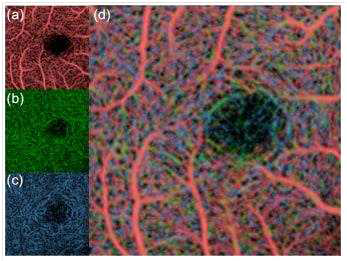 (a)-(c) show slab OCT-A images at different depths and correspond to Figs. 8(a)-(c), respectively. These images are color-coded and are then combined as shown in (d)