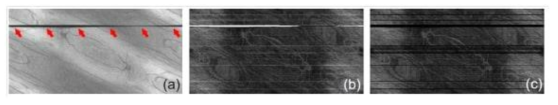 Examples of non-Cartesian remapped OCT (a) and OCT-A (b). The blink appears as the dark horizontal line in the OCT image and as the white (highly decorrelated) line in the OCT-A image. The blink region is removed from the OCT-A image at the same time as the rapid motion artifacts (c)