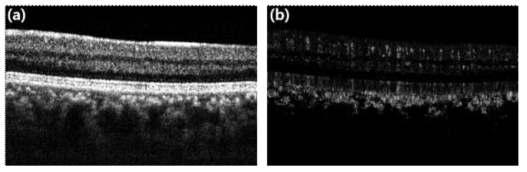 OCT intensity 영상 (a)와 IBDV 알고리즘을 이용하여 획득한 혈관의 단면영상 (b)