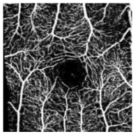 1차년도에 개발한 200kHz SS-OCT 시스템으로 획득한 혈관 영상. 스캔영역 : 3mm x 3mm (400 pixel x 400 pixel)