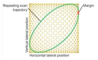 University of Tsukuba에서 개발한 Moton artifact 보정 기술에 사용한 Lissajous scan 패턴