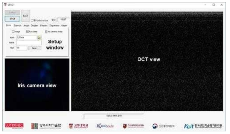 OCTA 시제품을 구동할 수 있는 OCT 소프트웨어