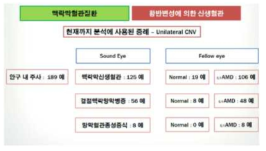 맥락막 혈관질환 중 황반변성에 의한 신생혈관 사례 분석