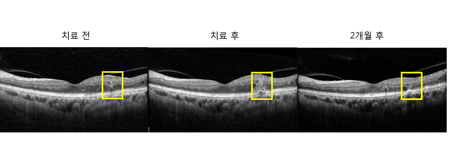 치료 전 후 변화