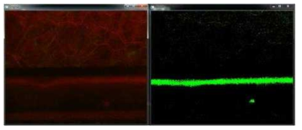 laser speckle을 만들면서 back scattered 된 영상을 CCD 카메라로 캡처해서 MHI를 연산한 결과