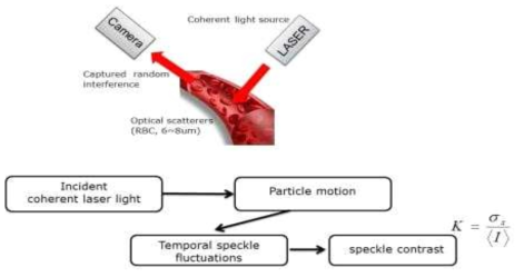 본 과제에서 적용한 혈관 내 RBC의 움직임에 의한 speckle fluctuation을 speckle contrast로 변환하는 영상처리 기법