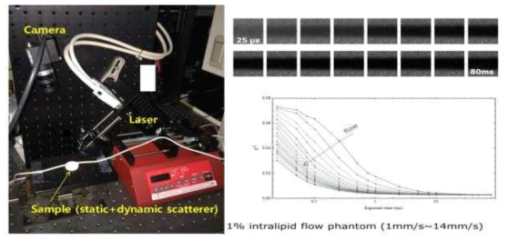 LSMA 기능영상 평가를 위한 시스템 구성(좌)과 flow phantom에서의 실험(우)