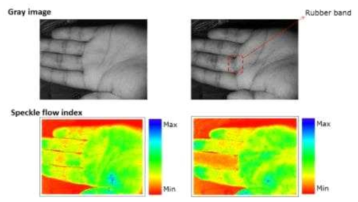 finger occlusion에서 speckle contrast 영상