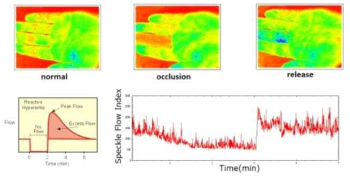 in vivo reactive hyperemia 실험에서의 혈류흐름의 영상의 동적 모니터링(left middle finger)