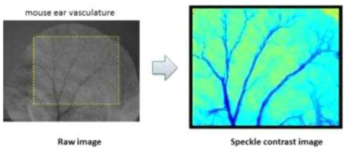 mouse micro-vasculature 에서의 LSMA 영상