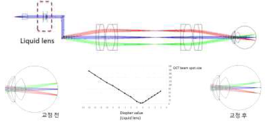 액체렌즈를 이용한 시력 보정