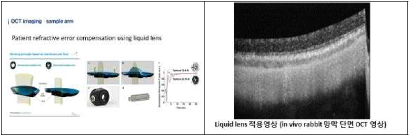 액체 렌즈 기술을 적용한 in-vivo OCT 영상