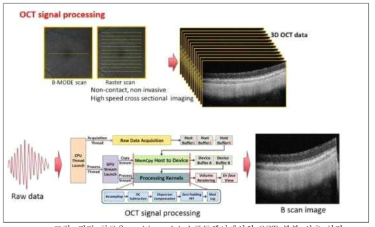 진단 치료용 multi-modal 소프트웨어에서의 OCT 부분 신호 처리