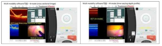 진단 치료용 multi-modal 소프트웨어의 화면 구성