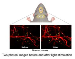 빛 자극 전후의 혈관 이완 변화 영상