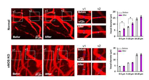 정상 쥐와 nNOS KO 쥐에 대한 빛 자극 전후의 혈관 이완