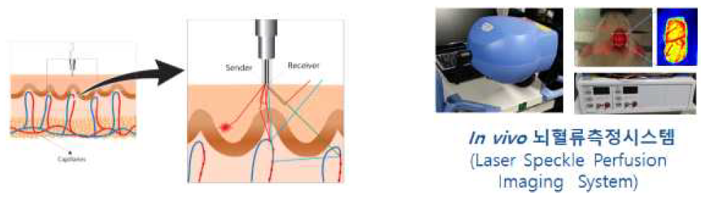 뇌혈류 측정을 위한 laser doppler 시스템의 프루브 및 imaigng 장비