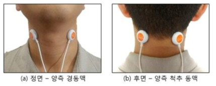 광선 조사 프로브 부착 위치