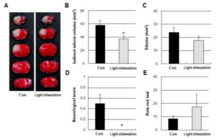 후처리-빛 자극 후 조직 회복능력, (A)TCC 염색, (B)뇌조식 손상도, (C)부종(Edema), (D)신경학적 결손, (E)운동 협응 능력