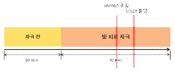 단일광자 단층촬영 프로토콜