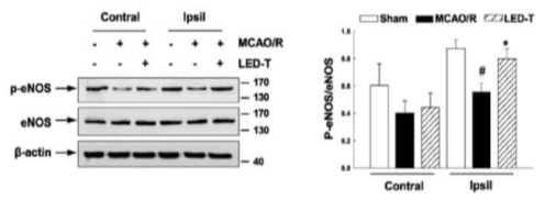 eNOS 인산화 효과, p-eNOS 발현변화