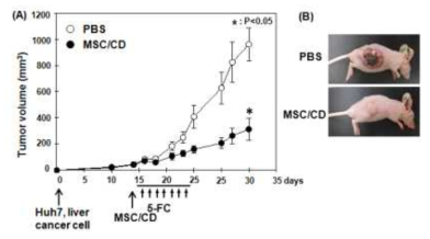피하조직 사람유래 간암 모델에서 CD발현 중간엽줄기세포와 5-FC 투여를 통한 항암효과 확인