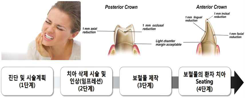 보철 치료 과정