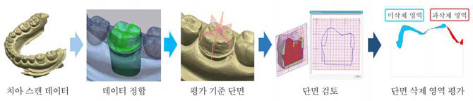 프렙 결과물 단면 삭제 영역 평가 기준