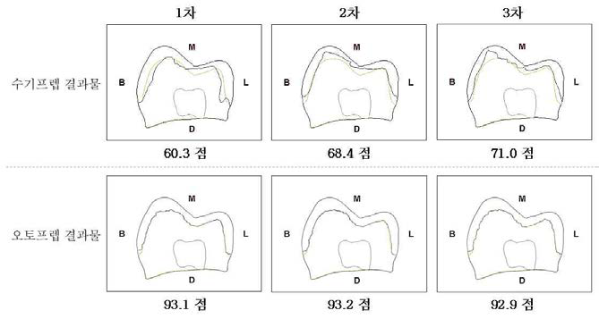 수기프렙과 오토프렙 결과 비교