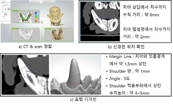 1차 전임상 프렙 디자인 프로세스