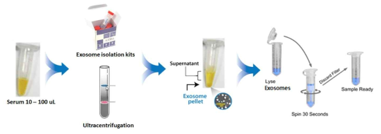 엑소좀 분리 과정