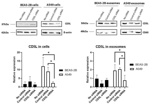 siRNA transfection 후 엑소좀과 세포주에서 CD5L 단백질 밸현량 분석