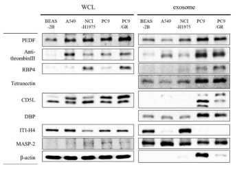 폐(암)세포의 whole cell lysate와 exosome에서의 serum 유래 exosomal biomarker 후보군의 발현 비교