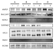 EGFR-TKI 감수성 단백질