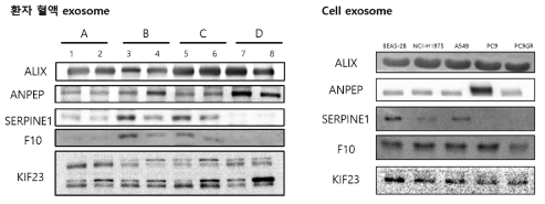 PC9/GR vs PC9 엑소좀 발굴 항암제 감수성 지표의 환자 엑소좀과 세포주 엑소좀에서의 발현 비교