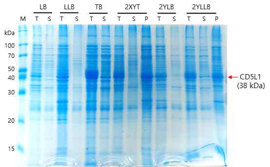 SDS-PAGE를 통한 CD5L1의 발현에 있어서 최적 배지 조건 비교. M: marker, T: Total, S: supernatant, P: Pellet