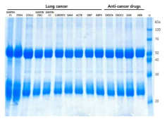 폐암 진단 마커와 항암제 감수성 마커의 항체 정제
