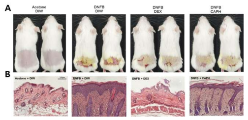 (A) DNFB 유도 아토피피부염 생쥐모델을 이용하여 CA-PH의 피부염증 완화. (B) CA-PH의 조직학적 완화. 양성대조군은 덱사메타손 (DEX)임