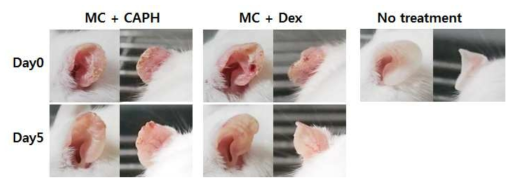 MC-903 처리에 의해 생쥐의 귀에서 아토피 피부염을 유발함. CA-PH 처리에 의해 증상이 완화됨