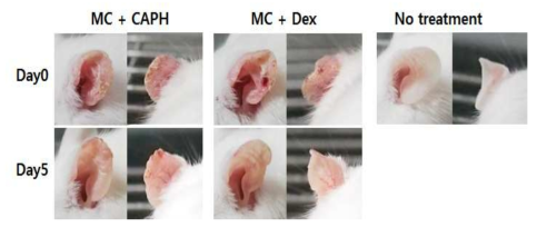 MC-903 처리에 의해 생쥐의 귀에서 아토피 피부염을 유발함. CA-PH 처리에 의해 증상이 완화됨