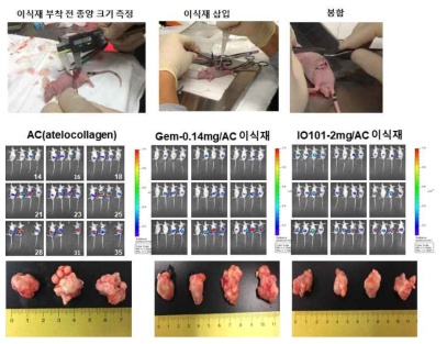 BxPC3 암세포주 주입 Orthotopic xenograft 췌장암 마우스 모델에서의 췌장암 억제 효과