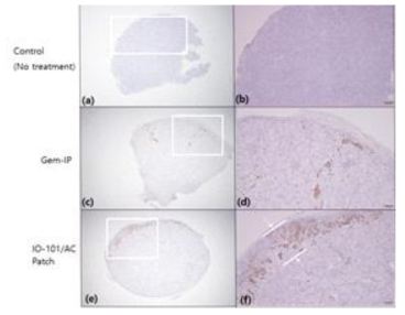 Histological analysis of apoptosis via TUNEL staining in pancreatic tumor